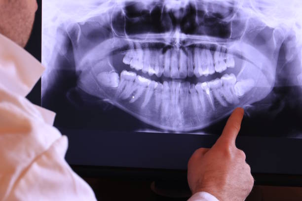 Best Emergency Dental Services for Seniors in Dermott, AR