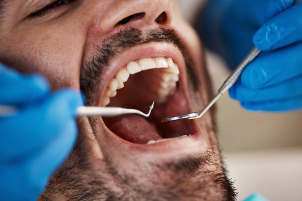 Best Urgent Dental Care for Toothache in Dermott, AR