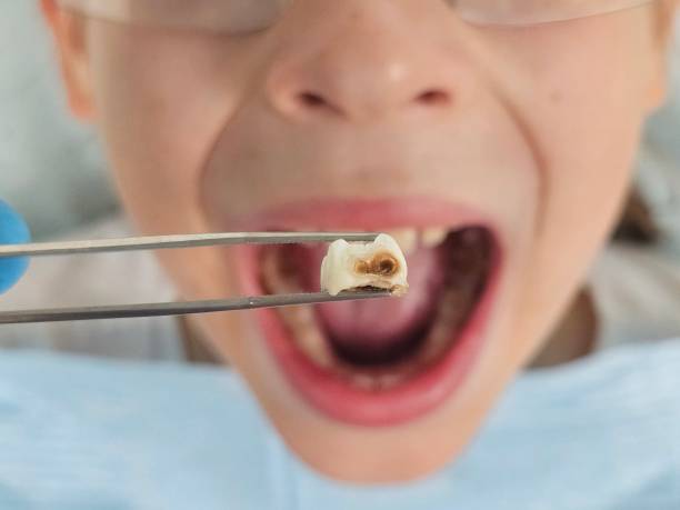 Best Weekend Emergency Dentist in Dermott, AR